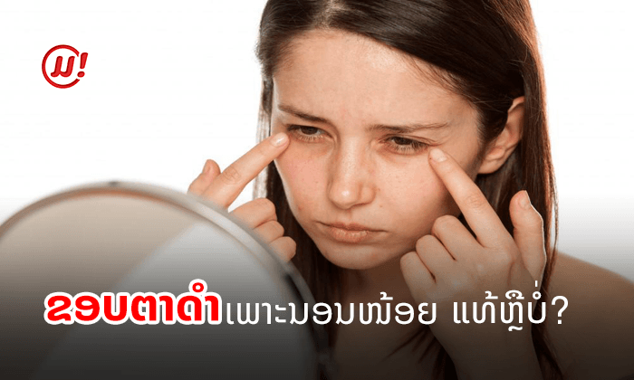 ໄຂຂໍ້ສົງໄສ! “ຂອບຕາດຳ” ເພາະນອນໜ້ອຍ ແທ້ ຫຼື ບໍ?