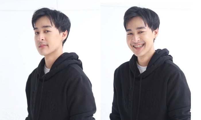 หล่อมาก "หม่อมเอ็ม" หลังผ่าตัดขากรรไกรแก้ไขฟันกรามล่างยื่น