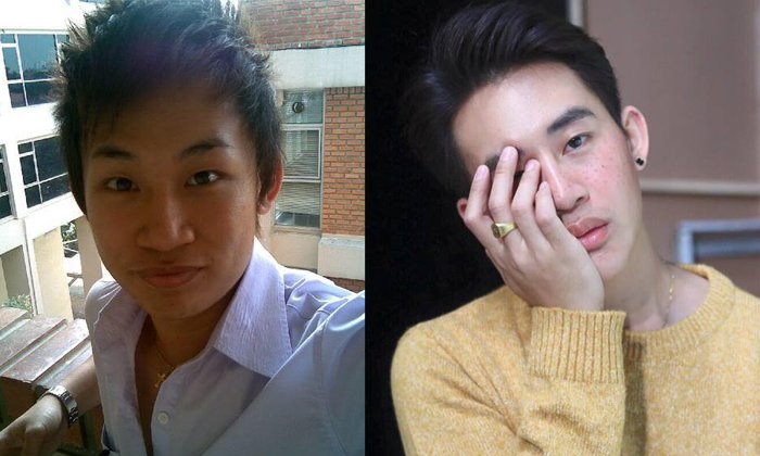 ศัลยกรรมเปลี่ยนหนุ่มหน้าบ้านๆ ให้หล่อใสสไตล์เกาหลี