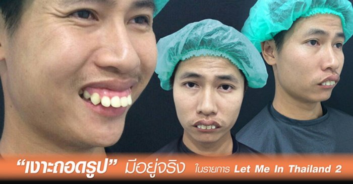 เงาะถอดรูปมีอยู่จริง ในรายการ Let Me In Thailand 2 สู่หนุ่มหล่อบาดใจสาว
