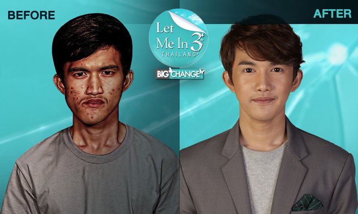 เหมือนตายแล้วเกิดใหม่! Let Me In Thailand ซีซั่น 3 เปลี่ยนหนุ่มโรงงานคางเบี้ยวให้ดูดีขึ้น