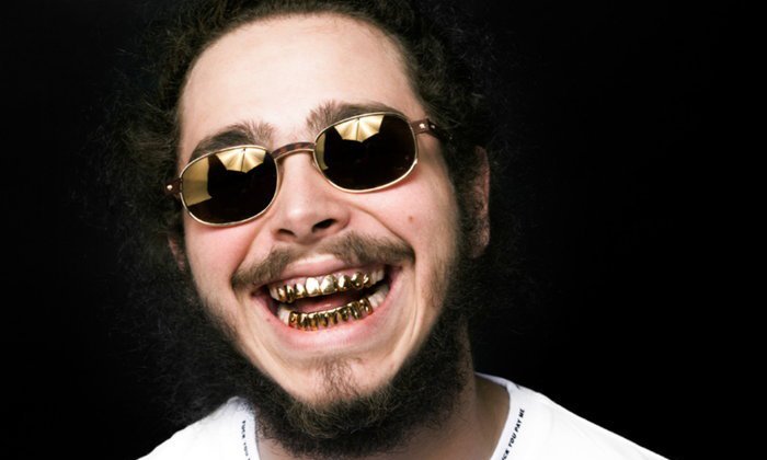 Grillz เครื่องประดับสุดเฟี้ยวที่สาวกฮิปฮอปต้องรู้จัก