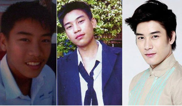 หล่อเอง หรือ ศัลยกรรม "เคน ภูภูมิ" หน้าตาดีขึ้นเป็นกอง