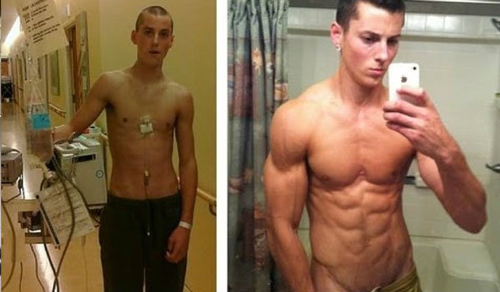Zach Zeiler จากคนป่วยมะเร็ง สู่นายแบบกล้ามโต