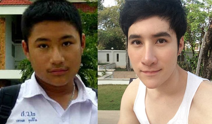 คิดก่อนทำ ศัลยกรรมเปลี่ยนชีวิต!!!