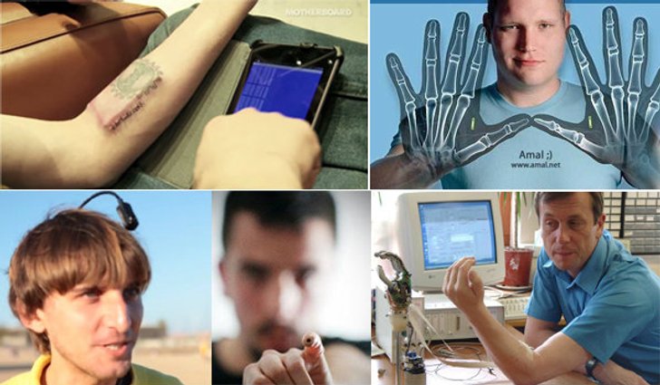 5 หนุ่มมนุษย์ไฮเทคฝัง Gadgets ในร่างกาย