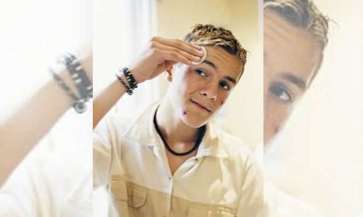 10 วิธีสุดเจ๋งรับมือปัญหาสิวแบบแมนๆ