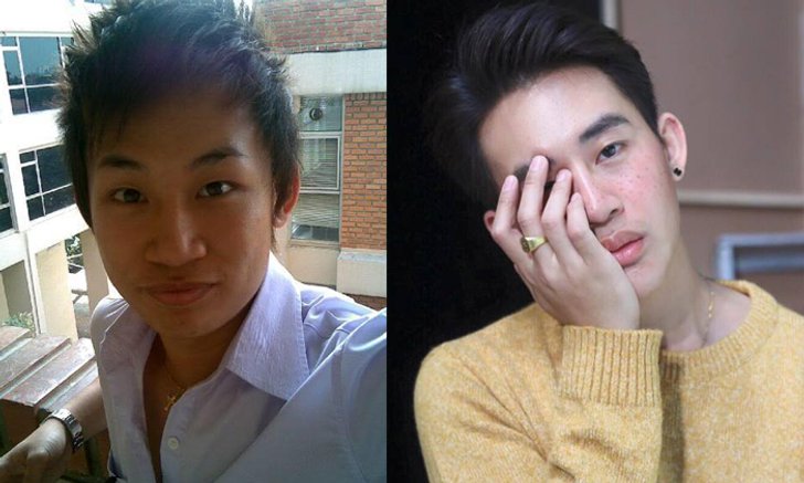 ศัลยกรรมเปลี่ยนหนุ่มหน้าบ้านๆ ให้หล่อใสสไตล์เกาหลี