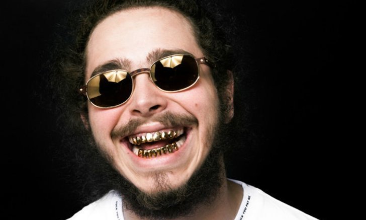 Grillz เครื่องประดับสุดเฟี้ยวที่สาวกฮิปฮอปต้องรู้จัก