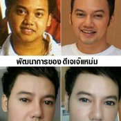 ศัลยกรรมผู้ชาย