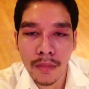 ศัลยกรรม