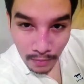 ศัลยกรรม