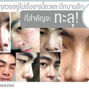 ศัลยกรรม