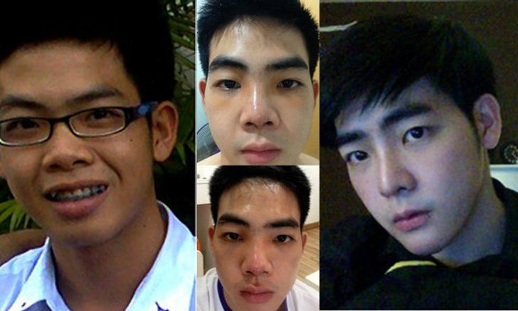 รีวิว ศัลยกรรมและการเปลี่ยนแปลงตัวเอง ให้กำลังใจและแรงผลักดันในการลุกขึ้นมาสู้อีกครั้ง