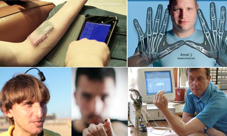 5 หนุ่มมนุษย์ไฮเทคฝัง Gadgets ในร่างกาย