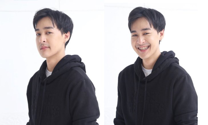 หล่อมาก "หม่อมเอ็ม" หลังผ่าตัดขากรรไกรแก้ไขฟันกรามล่างยื่น