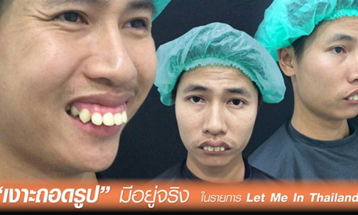 เงาะถอดรูปมีอยู่จริง ในรายการ Let Me In Thailand 2 สู่หนุ่มหล่อบาดใจสาว