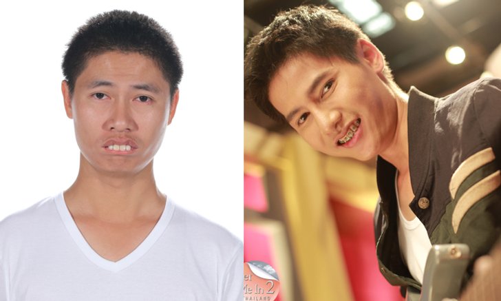 เปิดใจ แมท ปภาวิน หนุ่มโดนล้อแก้วหน้าม้า ศัลยกรรมจนหล่อมาก