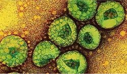 ควรรู้ไวรัส “เมิร์สคอฟ” เชื้อโรคล่าสุดที่ยังไม่มียารักษา ป้องกันไว้ก่อนดีกว่า