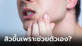 “การช่วยตัวเอง” ทำให้เป็นสิวจริงไหม?