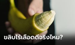 "ขลิบไร้เลือด" กับ "ขลิบธรรมดา" แบบไหนดีกว่ากัน?