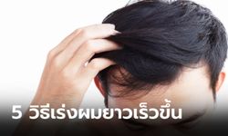 5 วิธีดูแลเส้นผมให้ยาวเร็วทันใจ ลดปัญหาผมบาง ผมร่วงอย่างได้ผล