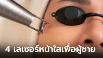 ไปรู้จัก 4 "เลเซอร์หน้าใส" สำหรับผู้ชาย มีอะไรบ้าง?