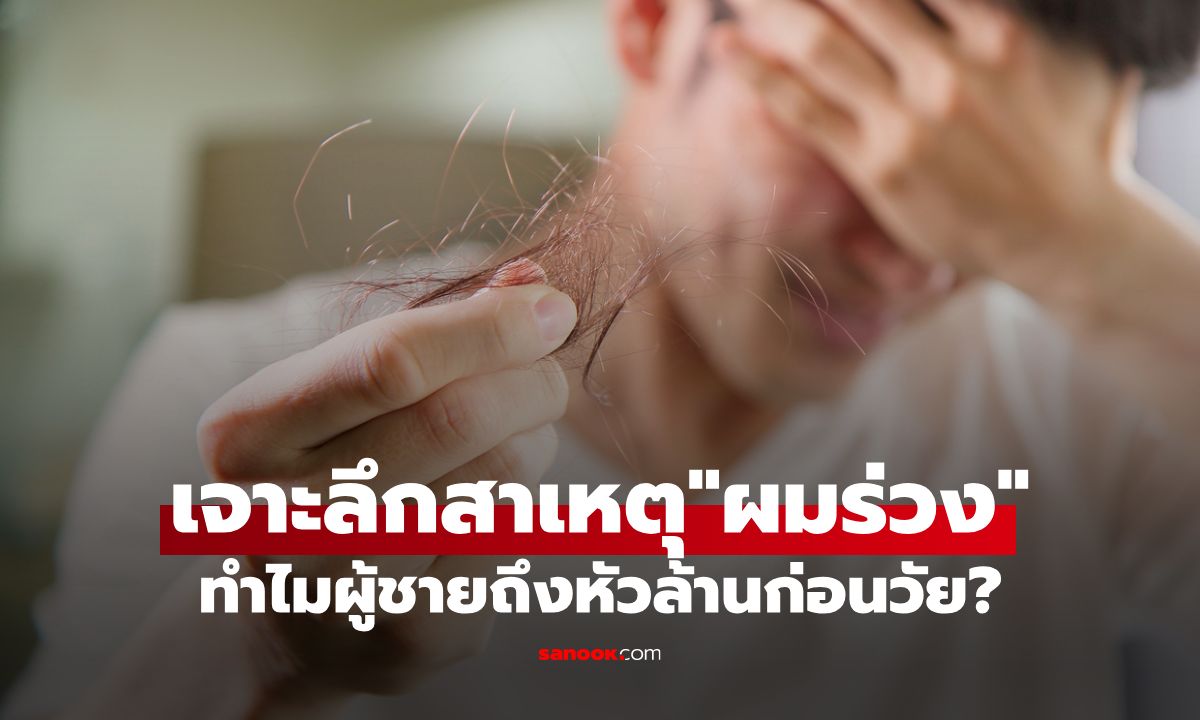 ผมร่วงในผู้ชาย รู้ลึกทุกสาเหตุผมร่วง ทำไมผู้ชายถึงหัวล้านก่อนวัย?