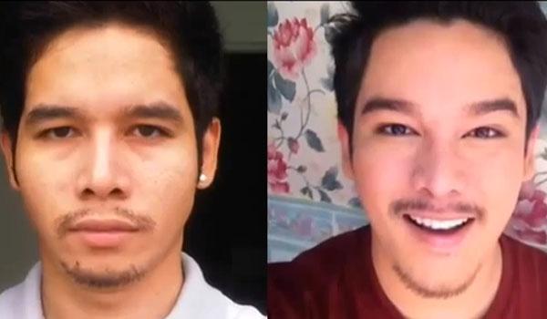 ศัลยกรรม