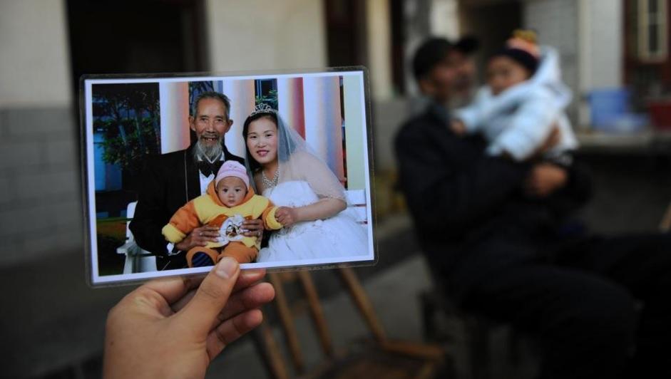 ชาย 72 สาว 27