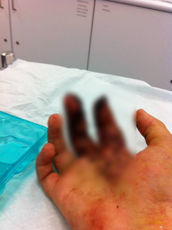 พลุระเบิด