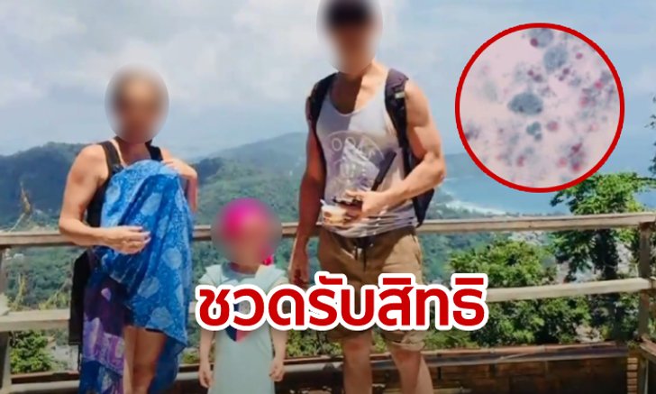 เปิดเกณฑ์เยียวยานักท่องเที่ยว หลังผัวเมียออสซี่โวยติดเชื้อปรสิตเพราะกินผัดไทย