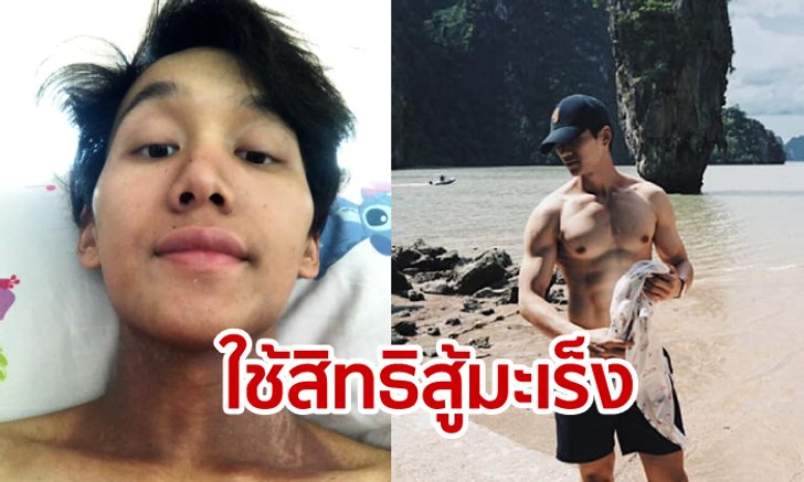 หนุ่มที่เคยป่วย มะเร็งโพรงจมูก หายได้ด้วย “สิทธิบัตรทอง-ประกันสังคม”