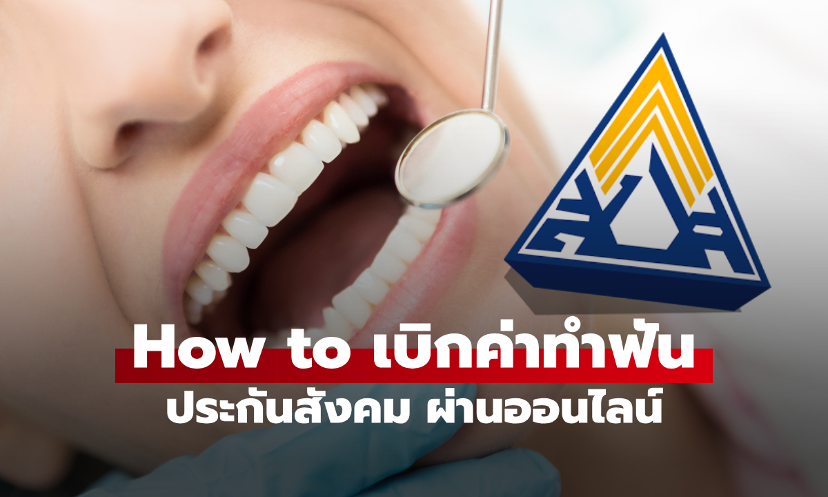 สิทธิทำฟันประกันสังคม 2569 เช็กเงื่อนไขเบิกฟรี 900 บาท ไม่ต้องสำรองจ่าย