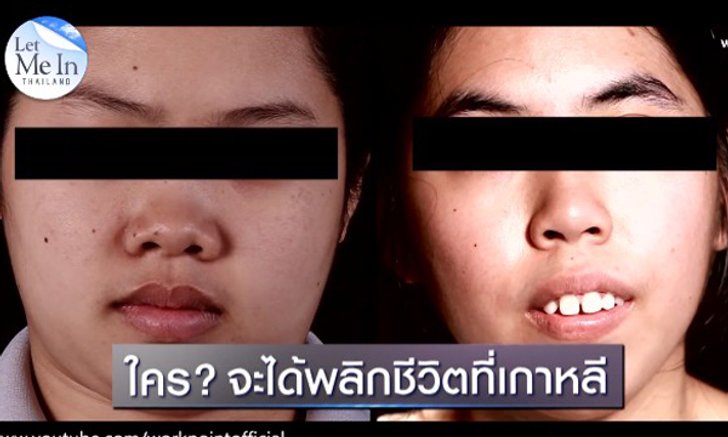 ศัลยกรรมเปลี่ยนชีวิต! Let Me In Thailand คนแรกของประเทศไทย