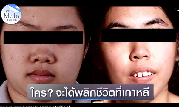 ศัลยกรรมเปลี่ยนชีวิต! Let Me In Thailand คนแรกของประเทศไทย
