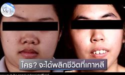 ศัลยกรรมเปลี่ยนชีวิต! Let Me In Thailand คนแรกของประเทศไทย