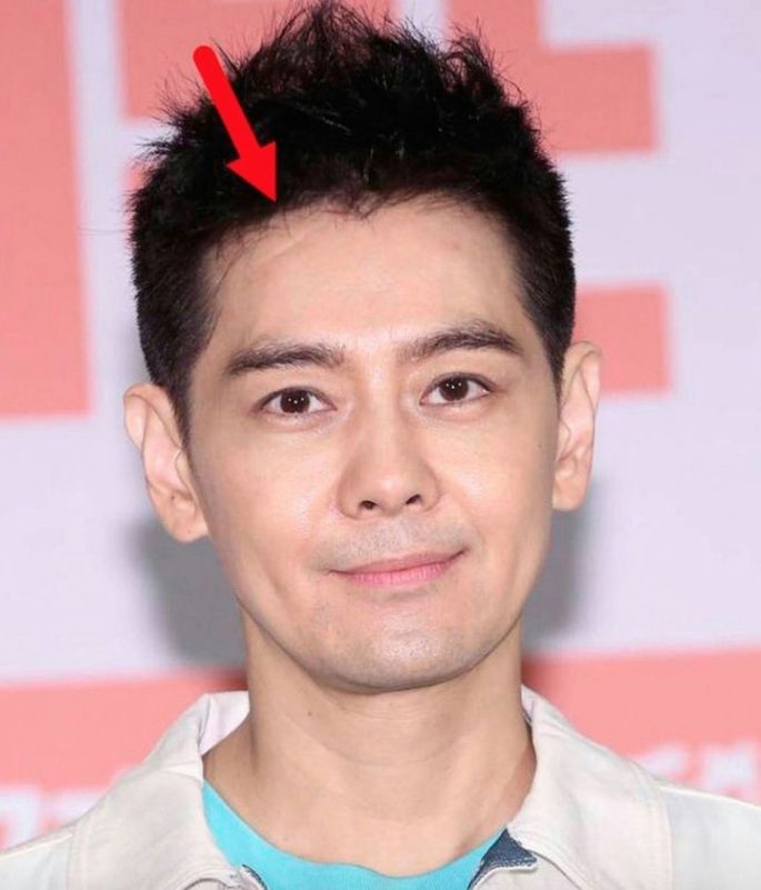 หลินจื้ออิง-Jimmy Lin