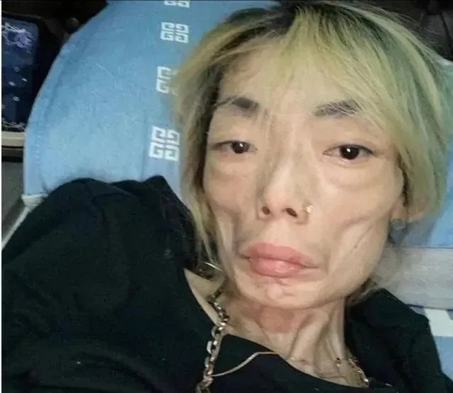 ดราม่าชีวิต อดีตนางแบบดัง ลดน้ำหนักเหลือแค่ 22 กก.
