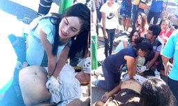 ชื่นชม ! พยาบาลผ่านมาพบเหตุรีบช่วยหนุ่มใหญ่ถูกรถชนสาหัส แม้สุดท้ายสุดยื้อ