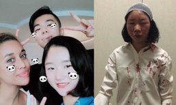 สาวจีนมึน! เดินเที่ยวอยู่ดีๆ ถูกชน-ตีหัวแตก เย็บ 6 เข็ม