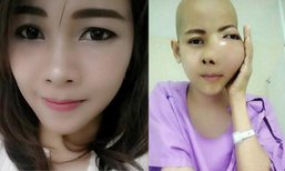 เจนี่ สาวป่วยมะเร็ง ใบหน้าบวม เสียชีวิตแล้ว