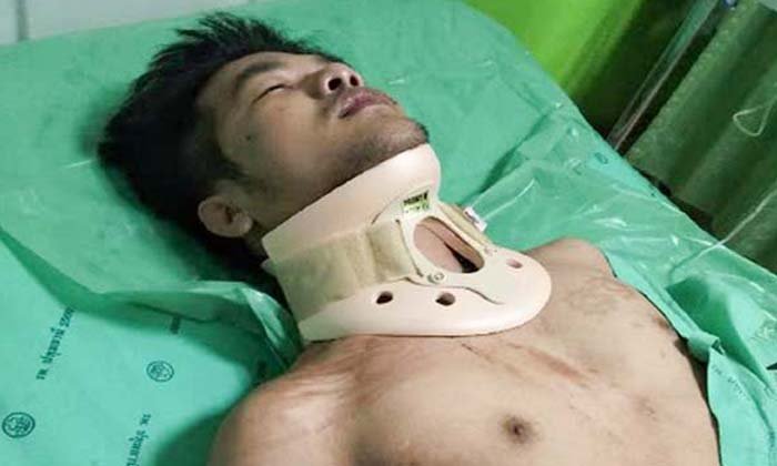 หนุ่มถูกยิงผิดตัว กระสุนฝังในคอเสี่ยงพิการ มือปืนไม่รับผิดชอบ หลัง ตร.ปล่อยตัว