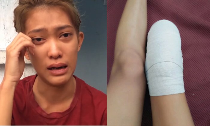 สาวถูกรถชนจนต้อง "ตัดขา" คู่กรณีไม่สำนึกด่าสำออย-ท้าให้ฟ้อง