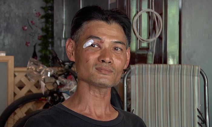 ผิดถูกให้สังคมตัดสิน นักปั่นบาดเจ็บในคลิปดัง เปิดใจ ไม่คิดเรียกร้องอะไร
