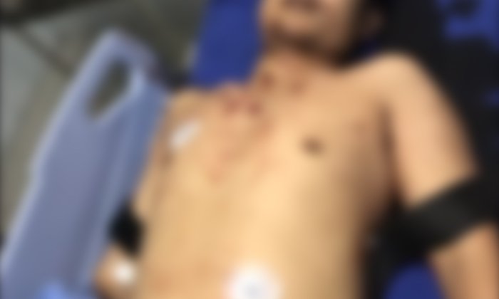 หนุ่มหัวเกรียนโมโหถูกปาด ชกคนขับคู่กรณี - ยิงตำรวจป.ป.ส. ที่นั่งมาด้วยดับ