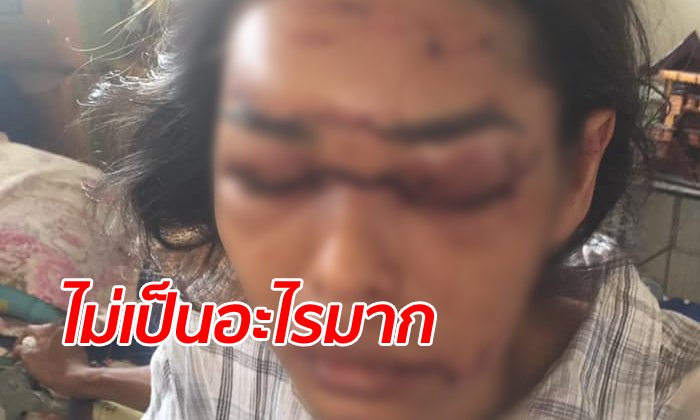 ญาติโวยโรงพยาบาลสะเพร่า สาวรถชนโคม่าแต่ไม่ให้แอดมิท หวิดหน้าเบี้ยว-ตาบอด
