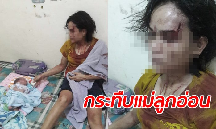 ประณามผัวใจเหี้ยม กระทืบเมียเลือดอาบ แม่นั่งให้นมลูกน้อยสภาพสะบักสะบอม