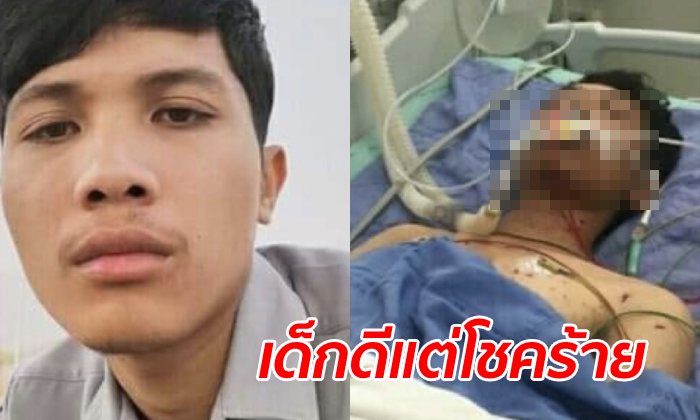 นักศึกษาปี 2 ทำงานหาเงินเรียน เคราะห์ร้ายพลุระเบิดใส่ ต้องตัดแขนขารักษาชีวิต