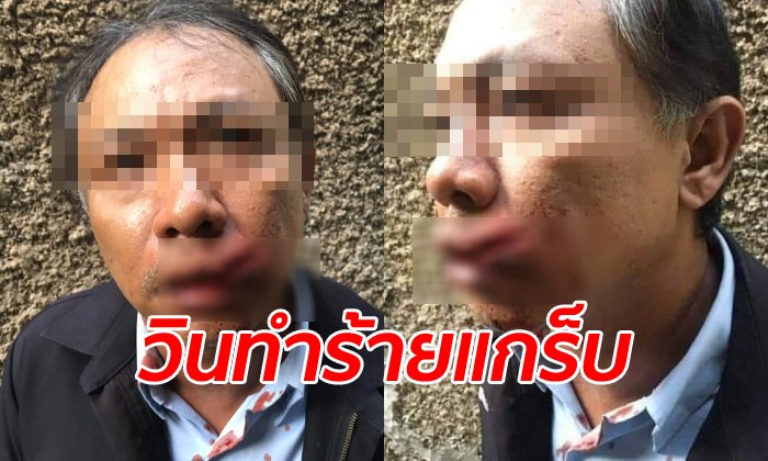 โหดเกินเรื่อง หลานสาวโพสต์ภาพ "ลุงแกร็บไบค์" ถูกวิน จยย.ทำร้ายถึงขั้นปากฉีก
